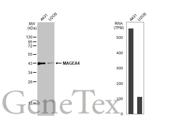 Various whole cell extracts (30 μg) were separated by 12% SDS-PAGE, and the membrane was blotted with MAGEA4 antibody (GTX116357) diluted at 1:2000. The HRP-conjugated anti-rabbit IgG antibody (GTX213110-01) was used to detect the primary antibody. Corresponding RNA expression data for the same cell lines are based on Human Protein Atlas program. Various whole cell extracts (30 μg) were separated by 12% SDS-PAGE, and the membrane was blotted with MAGEA4 antibody (GTX116357) diluted at 1:2000. The HRP-conjugated anti-rabbit IgG antibody (GTX213110-01) was used to detect the primary antibody. Corresponding RNA expression data for the same cell lines are based on Human Protein Atlas program.
