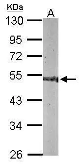 Sample (50 ug of whole cell lysate) A: mouse brain 10% SDS PAGE GTX116375 diluted at 1:1000 Sample (50 ug of whole cell lysate) A: mouse brain 10% SDS PAGE GTX116375 diluted at 1:1000