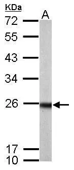 Sample (50 ug of whole cell lysate) A: mouse brain 12% SDS PAGE GTX116390 diluted at 1:1000 Sample (50 ug of whole cell lysate) A: mouse brain 12% SDS PAGE GTX116390 diluted at 1:1000