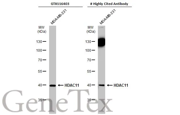 Whole cell extract (30 μg) was separated by 10% SDS-PAGE, and the membrane was blotted with HDAC11 antibody (GTX116403) diluted at 1:500. The HRP-conjugated anti-rabbit IgG antibody (GTX213110-01) was used to detect the primary antibody.