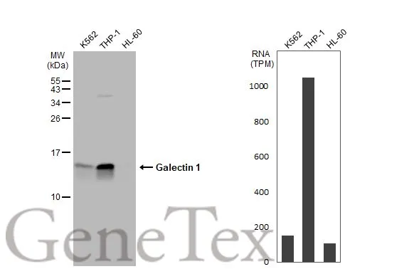 Various whole cell extracts (30 μg) were separated by 15% SDS-PAGE, and the membrane was blotted with Galectin 1 antibody (GTX116411) diluted at 1:2000. The HRP-conjugated anti-rabbit IgG antibody (GTX213110-01) was used to detect the primary antibody. Corresponding RNA expression data for the same cell lines are based on Human Protein Atlas program.
