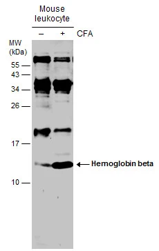Untreated (–) and treated (+) mouse tissue extracts (30 μg) were separated by 15% SDS-PAGE, and the membrane was blotted with Hemoglobin beta antibody (GTX116412) diluted at 1:500. (CFA: Complete Freunds adjuvant)