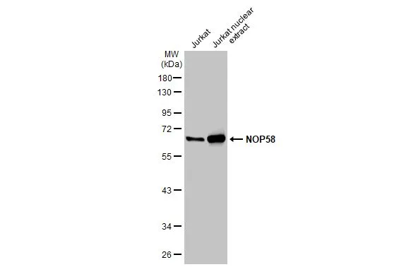 Jurkat whole cell and nuclear extracts (30 μg) were separated by 10% SDS-PAGE, and the membrane was blotted with NOP58 antibody [N1N3] (GTX116419) diluted at 1:1000. The HRP-conjugated anti-rabbit IgG antibody (GTX213110-01) was used to detect the primary antibody.