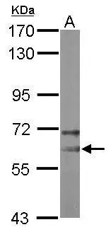 Sample (50 ug of whole cell lysate) A: mouse brain 7.5% SDS PAGE GTX116419 diluted at 1:10000