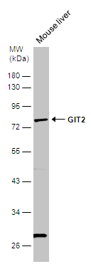 Mouse tissue extract (50 μg) was separated by 10% SDS-PAGE, and the membrane was blotted with GIT2 antibody [N1N3] (GTX116427) diluted at 1:1000.