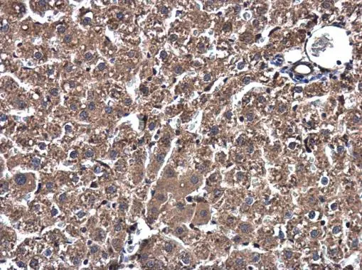 SSU72 antibody [N1C3] detects SSU72 protein at cytoplasm in rat liver by immunohistochemical analysis. Sample: Paraffin-embedded rat liver. SSU72 antibody [N1C3] (GTX116436) diluted at 1:500. 
 Antigen Retrieval: Citrate buffer, pH 6.0, 15 min
