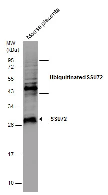 Mouse tissue extract (50 μg) was separated by 12% SDS-PAGE, and the membrane was blotted with SSU72 antibody [N1C3] (GTX116436) diluted at 1:1000.