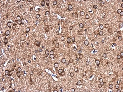 EHD4 antibody detects EHD4 protein at cytoplasm in rat brain by immunohistochemical analysis. Sample: Paraffin-embedded rat brain. EHD4 antibody (GTX116444) diluted at 1:500. 
 Antigen Retrieval: Trilogy? (EDTA based, pH 8.0) buffer, 15min