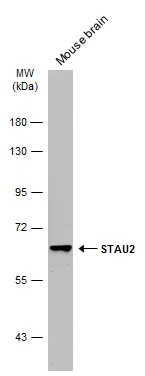 Mouse tissue extract (50 μg) was separated by 7.5% SDS-PAGE, and the membrane was blotted with STAU2 antibody (GTX116458) diluted at 1:1000. The HRP-conjugated anti-rabbit IgG antibody (GTX213110-01) was used to detect the primary antibody. Mouse tissue extract (50 μg) was separated by 7.5% SDS-PAGE, and the membrane was blotted with STAU2 antibody (GTX116458) diluted at 1:1000. The HRP-conjugated anti-rabbit IgG antibody (GTX213110-01) was used to detect the primary antibody.