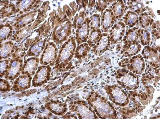 TRIP15 antibody