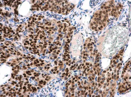 INTS4 antibody [N1N2], N-term detects INTS4 protein at nucleus in mouse ovary by immunohistochemical analysis. Sample: Paraffin-embedded mouse ovary. INTS4 antibody [N1N2], N-term (GTX116519) diluted at 1:500. 
 Antigen Retrieval: Citrate buffer, pH 6.0, 15 min