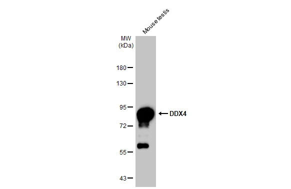 Mouse tissue extract (30 | 50 μg) was separated by 7.5% SDS-PAGE, and the membrane was blotted with DDX4 antibody [C1C3] (GTX116575) diluted at 1:1000. The HRP-conjugated anti-rabbit IgG antibody (GTX213110-01) was used to detect the primary antibody.