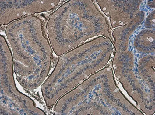 PPP2R2D antibody [N2C3] detects PPP2R2D protein at cytoplasm in mouse duodenum by immunohistochemical analysis. Sample: Paraffin-embedded mouse duodenum. PPP2R2D antibody [N2C3] (GTX116609) diluted at 1:500. 
 Antigen Retrieval: Citrate buffer, pH 6.0, 15 min