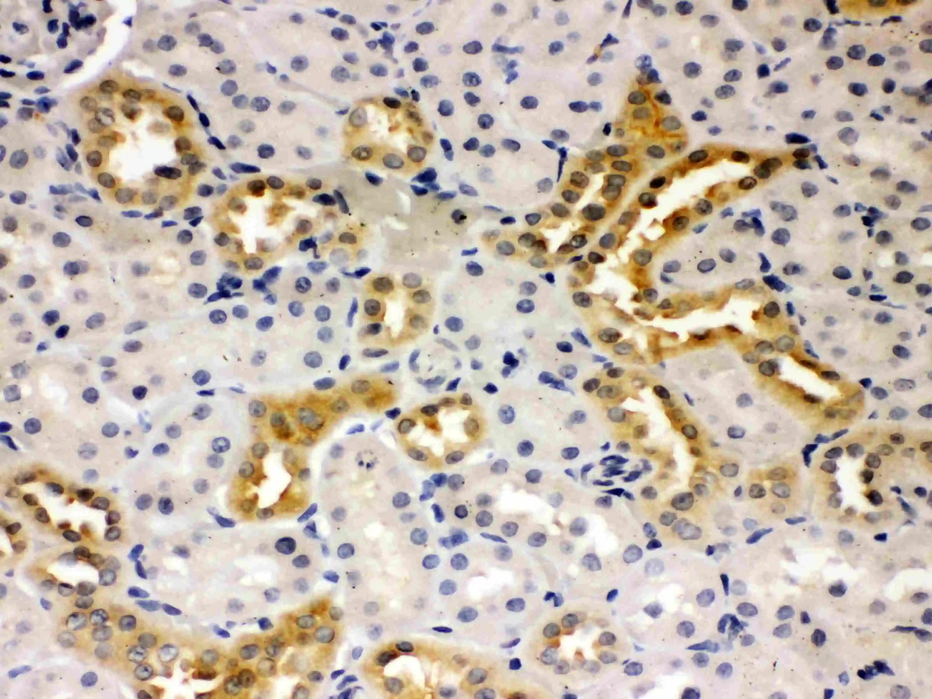 IHC-P analysis of rat kidney tissue using GTX11661 Presenilin 2 antibody.