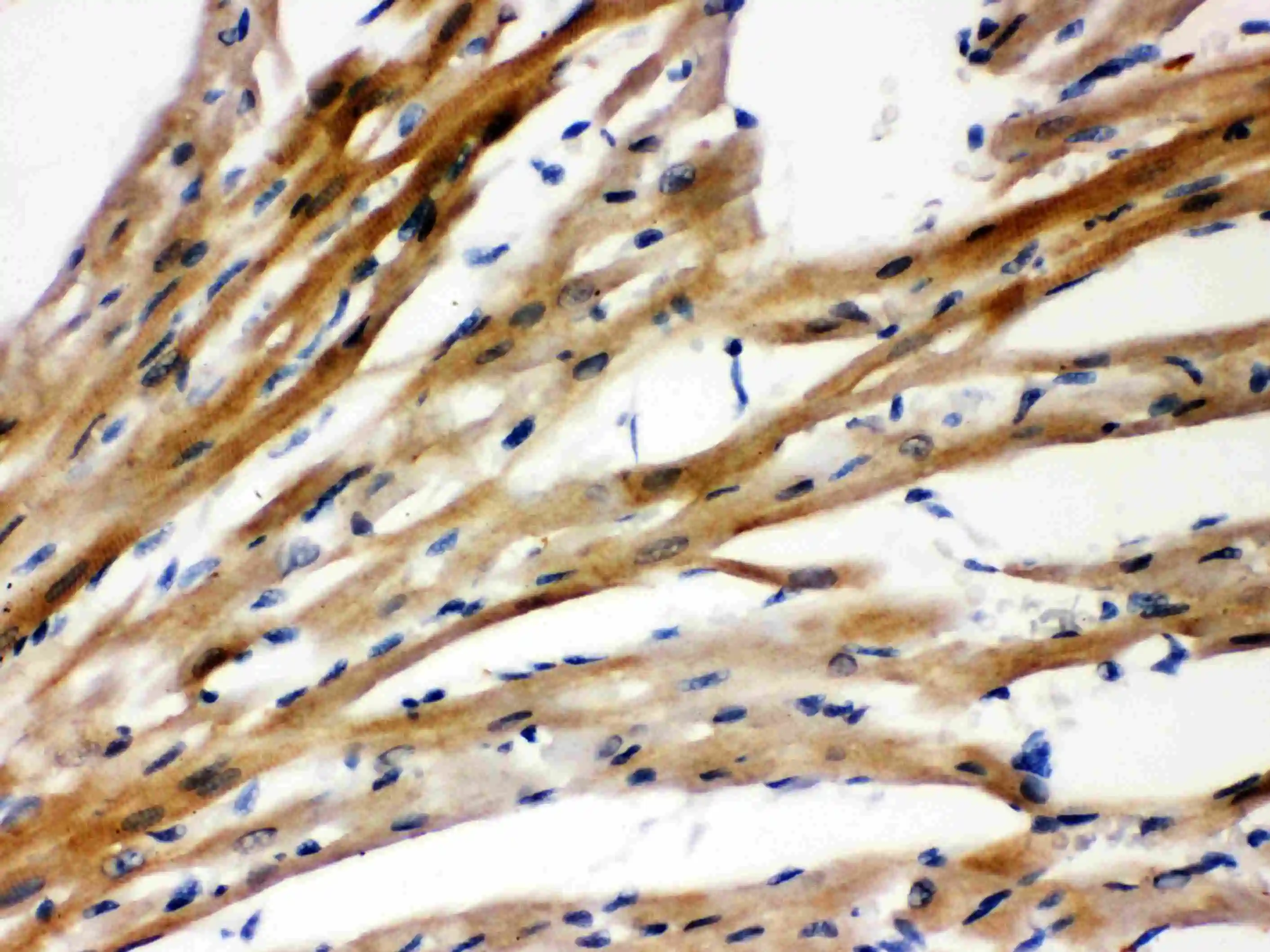 IHC-P analysis of rat cardiac muscle tissue using GTX11661 Presenilin 2 antibody.