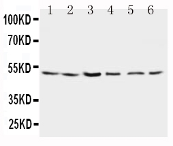 WB analysis of various samples using GTX11661 Presenilin 2 antibody. Lane 1 : rat brain tissue lysate Lane 2 : rat brain tissue lysate Lane 3 : MCF-7 cell lysate Lane 4 : HeLa cell lysate Lane 5 : SMMC cell lysate Lane 6 : CEM cell lysate