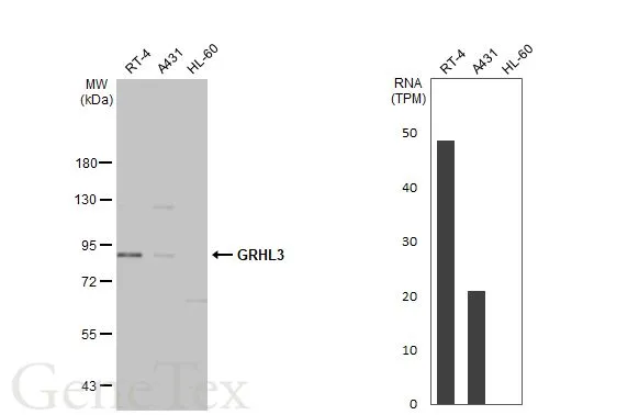 Various whole cell extracts (30 μg) were separated by 7.5% SDS-PAGE, and the membrane was blotted with GRHL3 antibody (GTX116700) diluted at 1:5000. The HRP-conjugated anti-rabbit IgG antibody (GTX213110-01) was used to detect the primary antibody, and the signal was developed with Trident ECL plus-Enhanced. Corresponding RNA expression data for the same cell lines are based on Human Protein Atlas program.