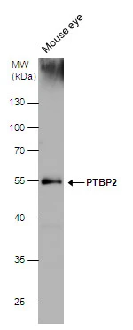 PTBP2 antibody detects PTBP2 protein by western blot analysis. Mouse tissue extracts (50 μg) was separated by 10% SDS-PAGE, and the membrane was blotted with PTBP2 antibody (GTX116704) diluted at 1:1000. PTBP2 antibody detects PTBP2 protein by western blot analysis. Mouse tissue extracts (50 μg) was separated by 10% SDS-PAGE, and the membrane was blotted with PTBP2 antibody (GTX116704) diluted at 1:1000.