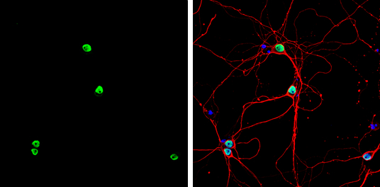 PTBP2 antibody detects PTBP2 protein by immunofluorescent analysis. Sample: DIV9 rat E18 primary hippocampal neuron cells were fixed in 4% paraformaldehyde at RT for 15 min. Green: PTBP2 stained by PTBP2 antibody (GTX116704) diluted at 1:500. Red: beta Tubulin 3/ Tuj1, stained by beta Tubulin 3/ Tuj1 antibody [GT11710] (GTX631836) diluted at 1:500. Blue: Fluoroshield with DAPI (GTX30920).