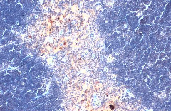 洋楽 CYTOTOXIN Anti-CXCL16 antibody (GTX116706) | GeneTex