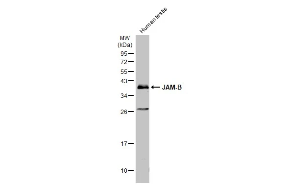 Human tissue extract (30 μg) was separated by 12% SDS-PAGE, and the membrane was blotted with JAM-B antibody [N2C3] (GTX116710) diluted at 1:500. The HRP-conjugated anti-rabbit IgG antibody (GTX213110-01) was used to detect the primary antibody.