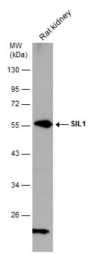 Rat tissue extract (50 μg) was separated by 10% SDS-PAGE, and the membrane was blotted with SIL1 antibody [N1N3] (GTX116755) diluted at 1:5000.