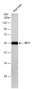 Rat tissue extract (50 μg) was separated by 10% SDS-PAGE, and the membrane was blotted with SIL1 antibody [N1C2] (GTX116756) diluted at 1:5000.