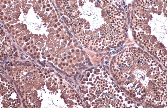 SMC6L1 antibody [N3C2], Internal detects SMC6L1 protein at nucleus by immunohistochemical analysis. Sample: Paraffin-embedded mouse testis. SMC6L1 stained by SMC6L1 antibody [N3C2], Internal (GTX116832) diluted at 1:500. Antigen Retrieval: Citrate buffer, pH 6.0, 15 min