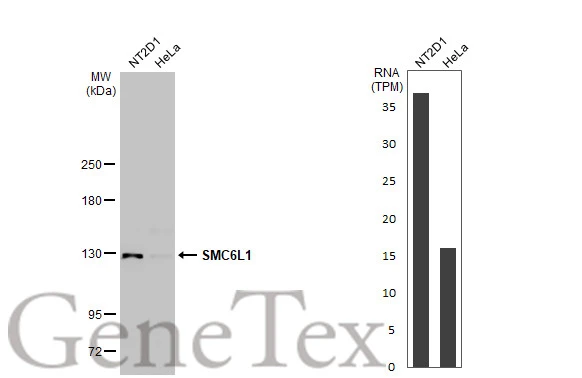 Various whole cell extracts (30 μg) were separated by 5% SDS-PAGE, and the membrane was blotted with SMC6L1 antibody [N3C2], Internal (GTX116832) diluted at 1:1000. The HRP-conjugated anti-rabbit IgG antibody (GTX213110-01) was used to detect the primary antibody, and the signal was developed with Trident ECL plus-Enhanced. Corresponding RNA expression data for the same cell lines are based on Human Protein Atlas program.