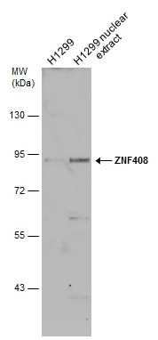 ZNF408 antibody