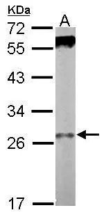 Sample (50 ug of whole cell lysate) A: mouse stomach 12% SDS PAGE GTX116881 diluted at 1:1000