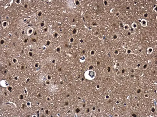 WDR61 antibody detects WDR61 protein at cytoplasm and nucleus in rat brain by immunohistochemical analysis. Sample: Paraffin-embedded rat brain. WDR61 antibody (GTX116882) diluted at 1:500. Antigen Retrieval: Citrate buffer, pH 6.0, 15 min