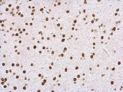 WDR61 antibody detects WDR61 protein at nucleus on mouse fore brain by immunohistochemical analysis. Sample: Paraffin-embedded mouse fore brain. WDR61 antibody (GTX116882) dilution: 1:500. Antigen Retrieval: Trilogy? (EDTA based, pH 8.0) buffer, 15min