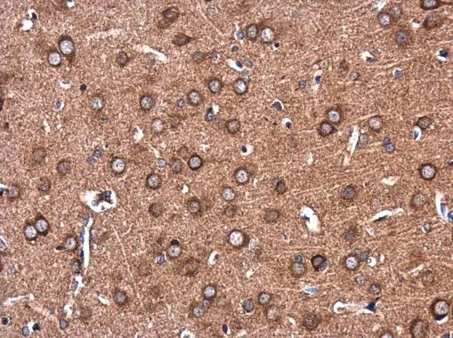 Colec12 antibody [N2C1], Internal detects Colec12 protein at cytoplasm in rat brain by immunohistochemical analysis. Sample: Paraffin-embedded rat brain. Colec12 antibody [N2C1], Internal (GTX116892) diluted at 1:500. 
 Antigen Retrieval: Trilogy? (EDTA based, pH 8.0) buffer, 15min
