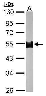 Sample (50 μg of whole cell lysate) A: mouse brain 10% SDS PAGE GTX116921 diluted at 1:1000 The HRP-conjugated anti-rabbit IgG antibody (GTX213110-01) was used to detect the primary antibody.