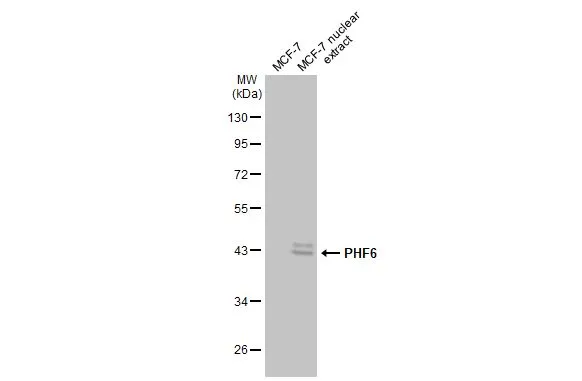 MCF-7 whole cell and nuclear extracts (30 μg) were separated by 10% SDS-PAGE, and the membrane was blotted with PHF6 antibody [N2C2], Internal (GTX116966) diluted at 1:1000. The HRP-conjugated anti-rabbit IgG antibody (GTX213110-01) was used to detect the primary antibody.