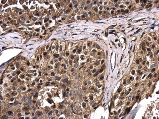 RERG antibody detects RERG protein in human lung by immunohistochemical analysis. Sample: Paraffin-embedded human lung. RERG antibody (GTX117011) diluted at 1:500. 
 Antigen Retrieval: Citrate buffer, pH 6.0, 15 min