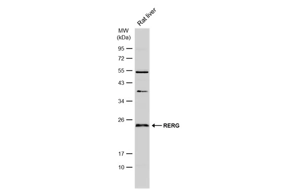 Rat tissue extract (50 μg) was separated by 12% SDS-PAGE, and the membrane was blotted with RERG antibody (GTX117011) diluted at 1:500. The HRP-conjugated anti-rabbit IgG antibody (GTX213110-01) was used to detect the primary antibody.