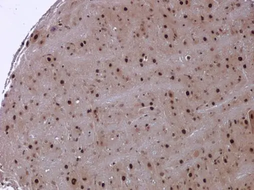 NAV2 antibody detects NAV2 protein at cytoplasm and nucleus in mouse brain by immunohistochemical analysis. Sample: Paraffin-embedded mouse brain. NAV2 antibody (GTX117023) diluted at 1:500. 
 Antigen Retrieval: Citrate buffer, pH 6.0, 15 min