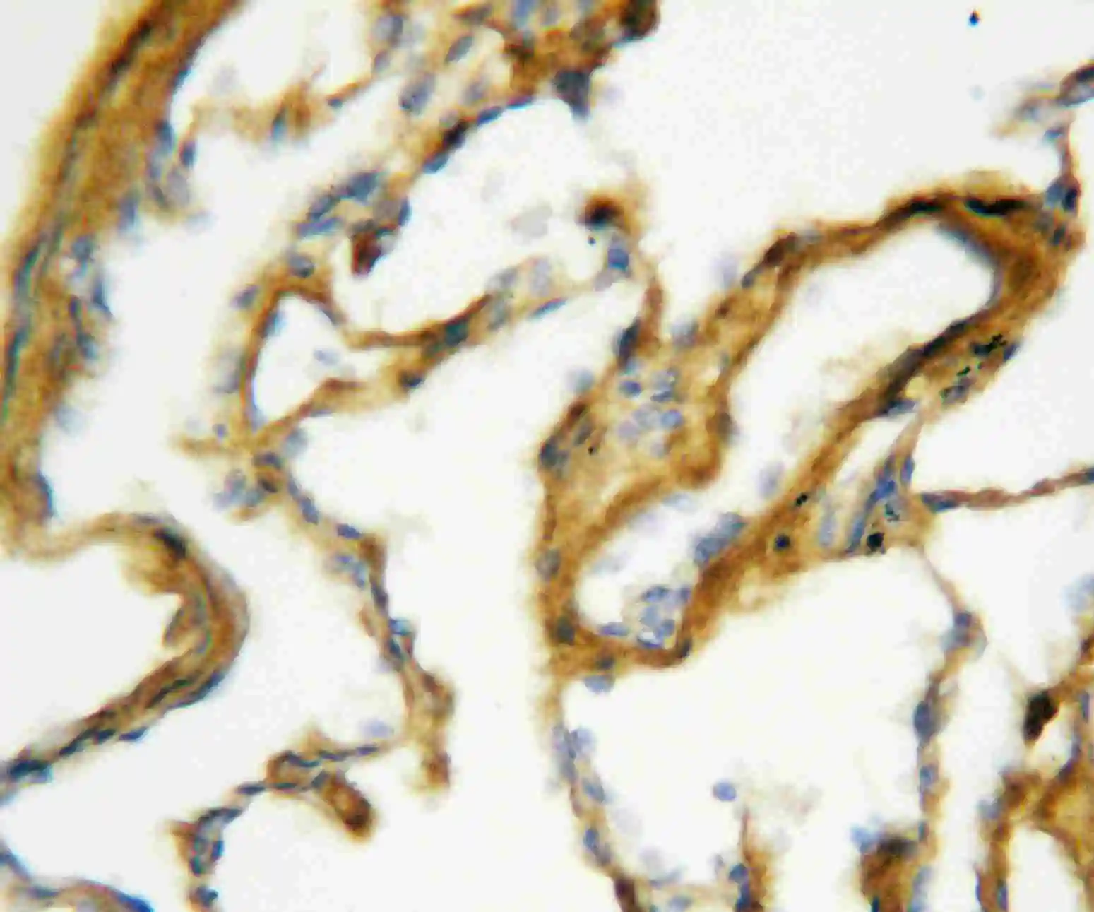 IHC-P analysis of rat lung tissue using GTX11706 Surfactant Protein A antibody. Antigen retireval : Heat mediated antigen retrieval was performed in citrate buffer (pH6, epitope retrieval solution) for 20 mins Dilution : 1microg/ml