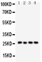 WB analysis of various samples using GTX11706 Surfactant Protein A antibody. Lane 1 : mouse lung tissue lysates Lane 2 : mouse lung tissue lysates Lane 3 : rat lung tissue lysates Lane 4 : rat lung tissue lysates Dilution : 0.5 microg/mL Loading : 50microg of sample under reducing conditions