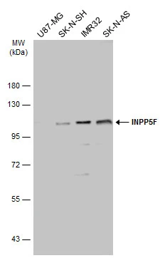Various whole cell extracts (30 μg) were separated by 7.5% SDS-PAGE, and the membrane was blotted with INPP5F antibody (GTX117067) diluted at 1:500. The HRP-conjugated anti-rabbit IgG antibody (GTX213110-01) was used to detect the primary antibody.
