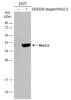 Non-transfected (–) and transfected (+) 293T whole cell extracts (30 μg) were separated by 12% SDS-PAGE, and the membrane was blotted with Nkx2.2 antibody [N2C3] (GTX117071) diluted at 1:5000. The HRP-conjugated anti-rabbit IgG antibody (GTX213110-01) was used to detect the primary antibody.