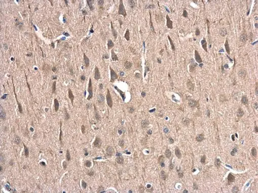 HIP1 Related antibody [N1N2], N-term detects HIP1 Related protein at cytoplasm in rat brain by immunohistochemical analysis. Sample: Paraffin-embedded rat brain. HIP1 Related antibody [N1N2], N-term (GTX117072) diluted at 1:500. 
 Antigen Retrieval: Citrate buffer, pH 6.0, 15 min