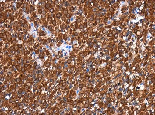 RGS6 antibody detects RGS6 protein at cytoplasm in rat ovary by immunohistochemical analysis. Sample: Paraffin-embedded rat ovary. RGS6 antibody (GTX117121) diluted at 1:500. 
 Antigen Retrieval: Trilogy? (EDTA based, pH 8.0) buffer, 15min