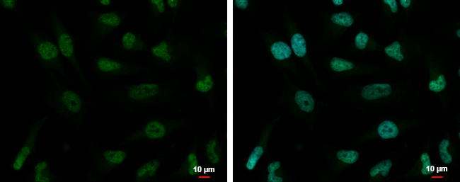 ZNF189 antibody detects ZNF189 protein at nucleus by immunofluorescent analysis.Sample:HeLa cells were fixed in 4% paraformaldehyde at RT for 15 min.Green:ZNF189 protein stained by ZNF189 antibody (GTX117129) diluted at 1:2000.Blue:Hoechst 33342 staining.