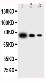 WB analysis of various samples using GTX11715 IL23 antibody. Lane 1 : Recombinant mouse IL-23 protein 10ng Lane 2 : Recombinant mouse IL-23 protein 5ng Lane 3 : Recombinant mouse IL-23 protein 2.5ng