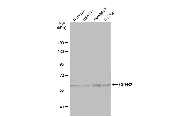 Various whole cell extracts (30 μg) were separated by 7.5% SDS-PAGE, and the membrane was blotted with CPEB2 antibody (GTX117457) diluted at 1:1000. The HRP-conjugated anti-rabbit IgG antibody (GTX213110-01) was used to detect the primary antibody, and the signal was developed with Trident ECL plus-Enhanced.