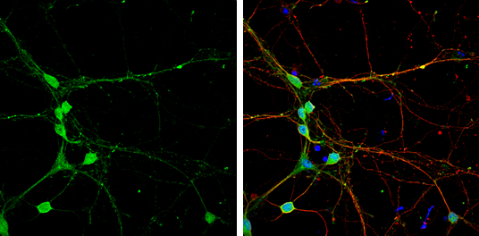 CLIP170 antibody [N1], N-term detects CLIP170 protein by immunofluorescent analysis. Sample: DIV9 rat E18 primary cortical neuron cells were fixed in 4% paraformaldehyde at RT for 15 min. Green: CLIP170 stained by CLIP170 antibody [N1], N-term (GTX117504) diluted at 1:500. Red: alpha Tubulin, stained by alpha Tubulin antibody [GT114] (GTX628802) diluted at 1:500. Blue: Fluoroshield with DAPI (GTX30920).
