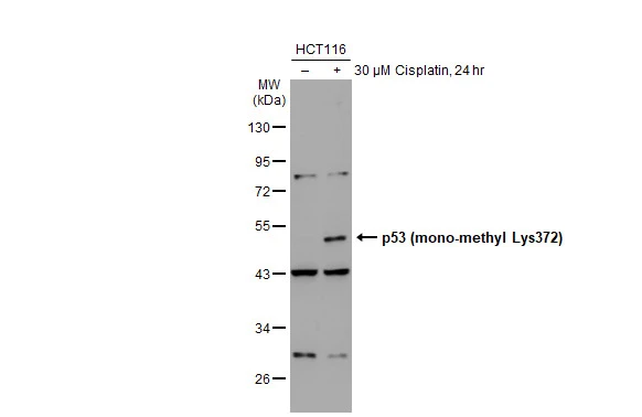 Untreated (–) and treated (+) HCT-116 whole cell extracts (30 μg) were separated by 10% SDS-PAGE, and the membrane was blotted with p53 (mono-methyl Lys372) antibody (GTX117515) diluted at 1:500. The HRP-conjugated anti-rabbit IgG antibody (GTX213110-01) was used to detect the primary antibody. Untreated (–) and treated (+) HCT-116 whole cell extracts (30 μg) were separated by 10% SDS-PAGE, and the membrane was blotted with p53 (mono-methyl Lys372) antibody (GTX117515) diluted at 1:500. The HRP-conjugated anti-rabbit IgG antibody (GTX213110-01) was used to detect the primary antibody.